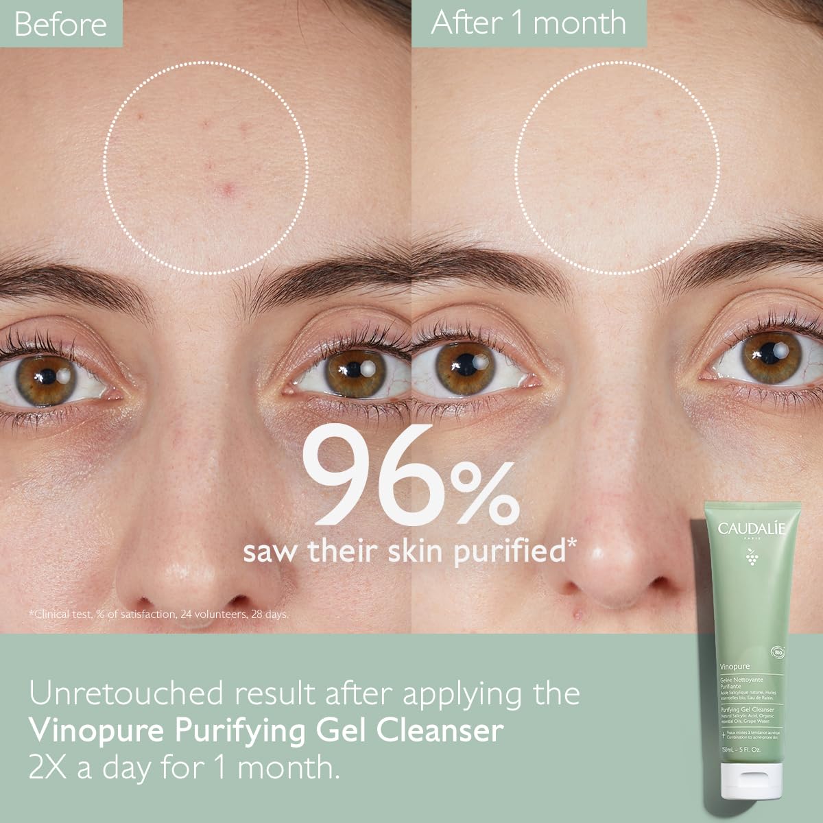 Refresh and Purify Your Skin with Vinopure Purifying Gel Cleanser - 150 Ml