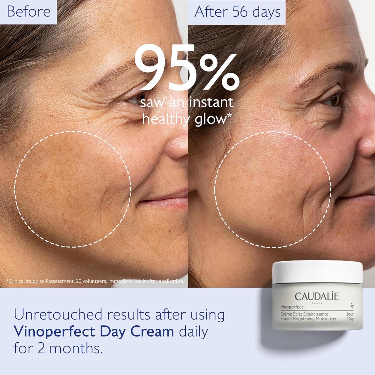 Illuminate Your Skin with Caudalie Vinoperfect Instant Brightening Moisturizer - Enriched with Niacinamide, 1.7 Fl. Oz
