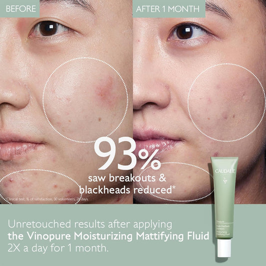 Vinopure Oil Control Moisturizer - Hydrate and Mattify Your Skin with French Elegance - 1 Oz